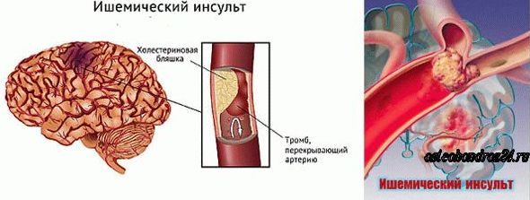 ЖИЗНЬ
